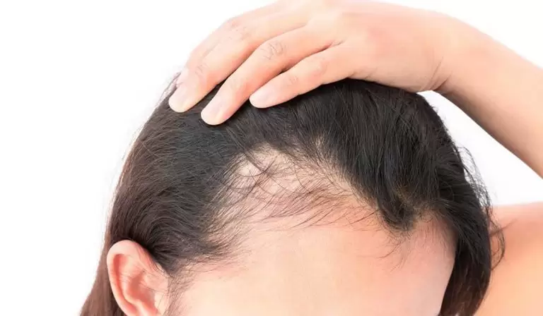 علاج الشعر الخفيف