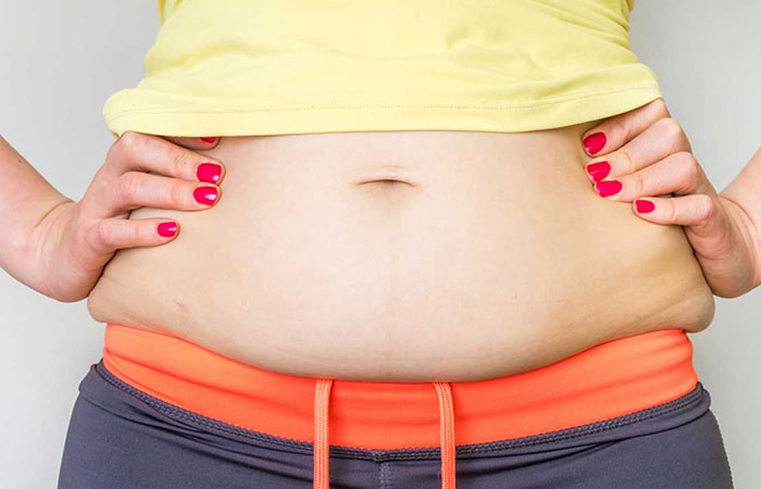 هل شفط الدهون ينقص الوزن