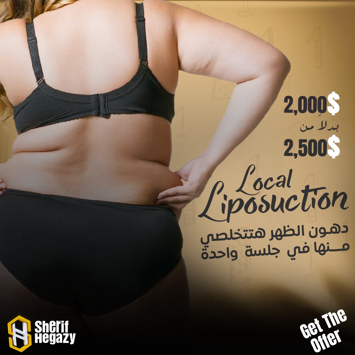 local liposuction offer