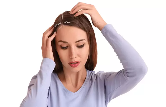 تكلفة زراعة الشعر للنساء في مصر