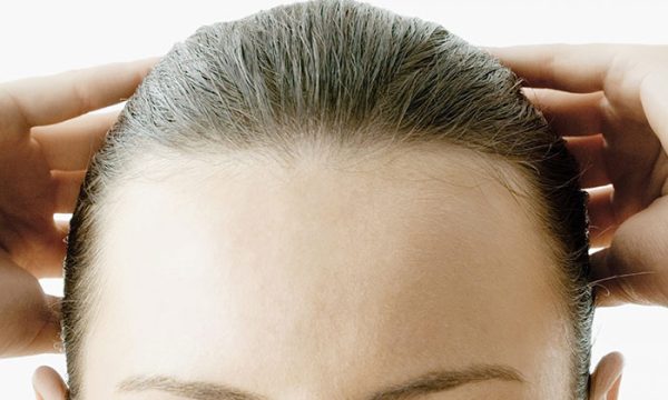 زراعة الشعر لتصغير الجبهة